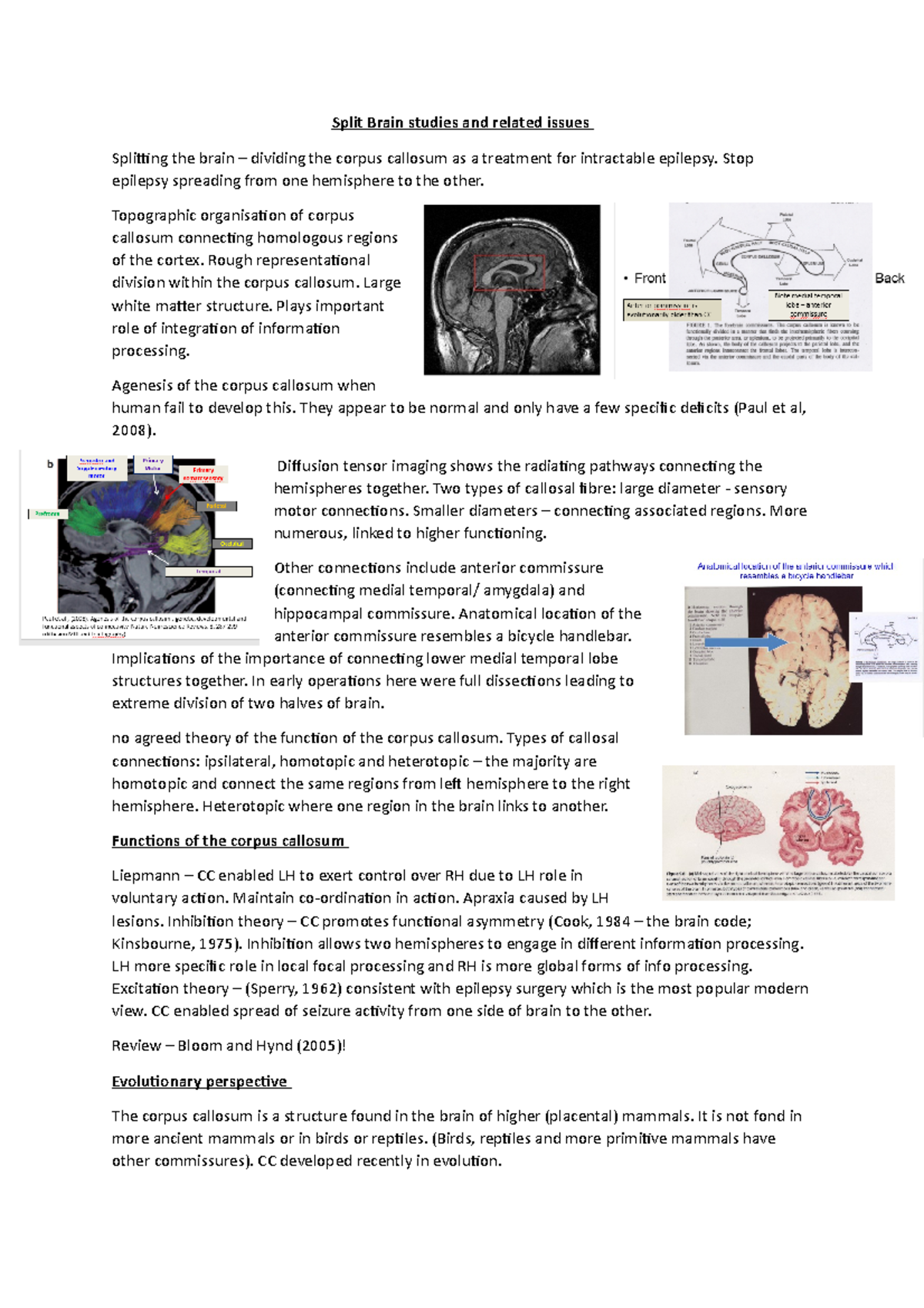 Lecture 9-10 split brain patients - Split Brain studies and related ...