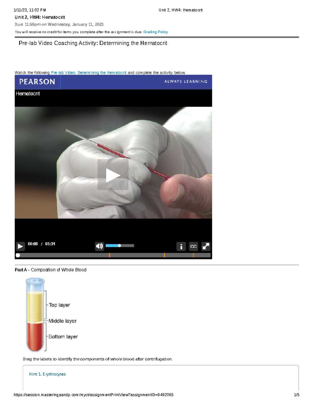 Unit 2, HW4 Hematocrit - Unit 2, HW4: Hematocrit Due: 11:59pm On ...