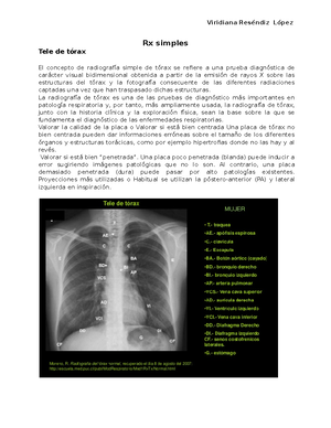 Como interpretar una Rx de Torax - INSTITUTO POLITECNICO NACIONAL ...