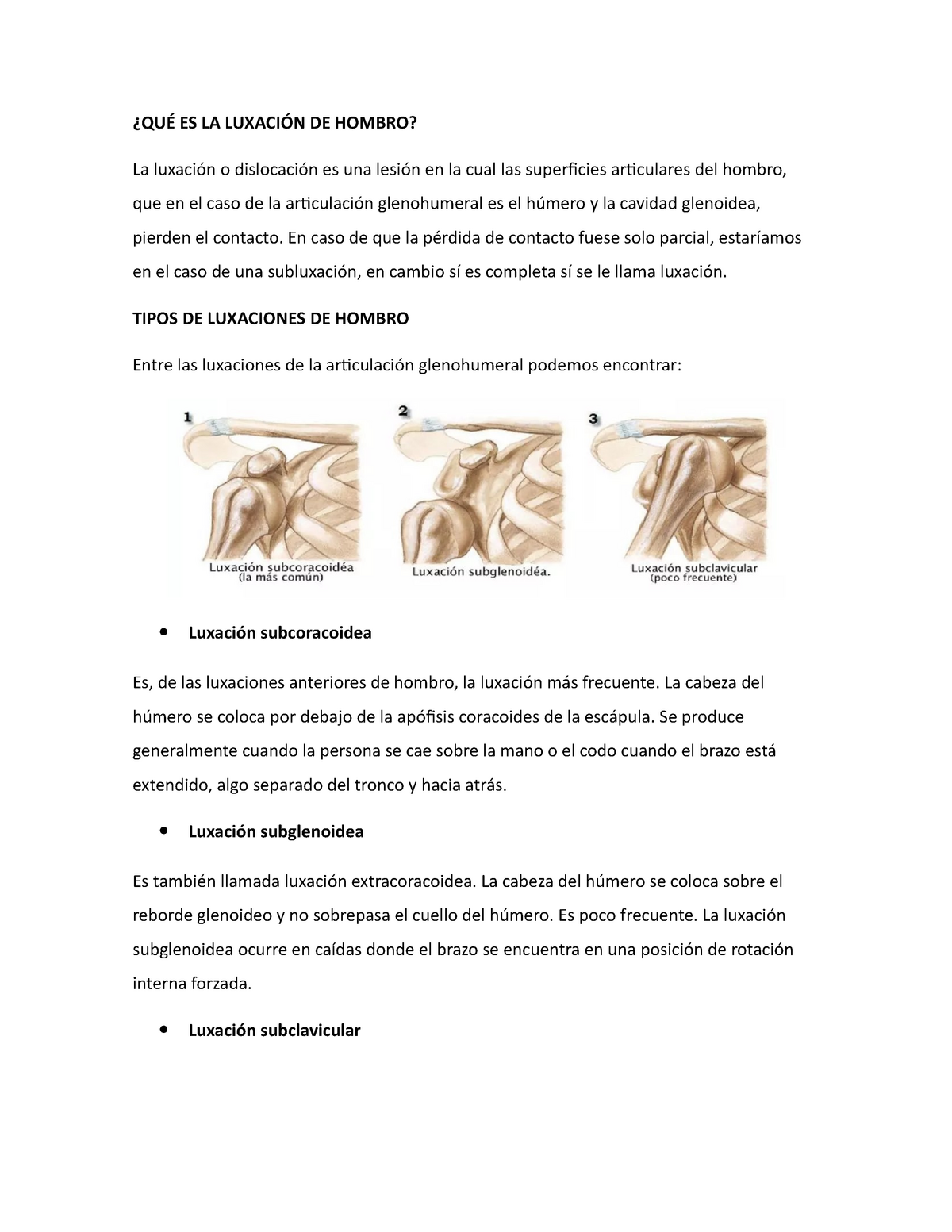 Maniobras Para Luxación De Hombro - ¿QUÉ ES LA LUXACIÓN DE HOMBRO? La ...