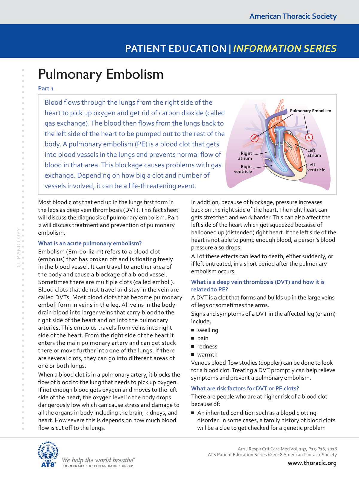 Pulmonary-embolism - Notes - American Thoracic Society PATIENT ...