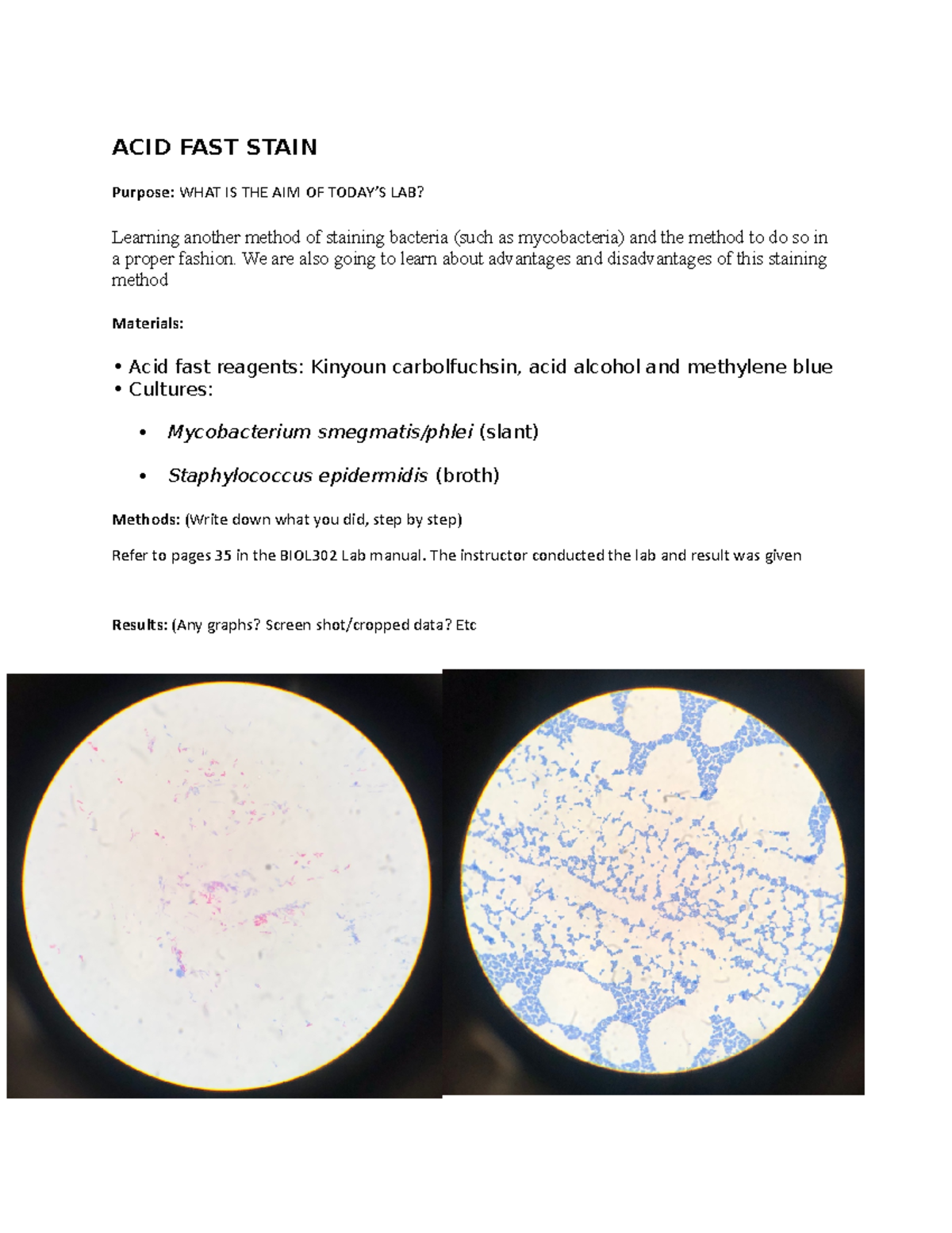 Acid Fast Staining Lab Report JadaanceKirby