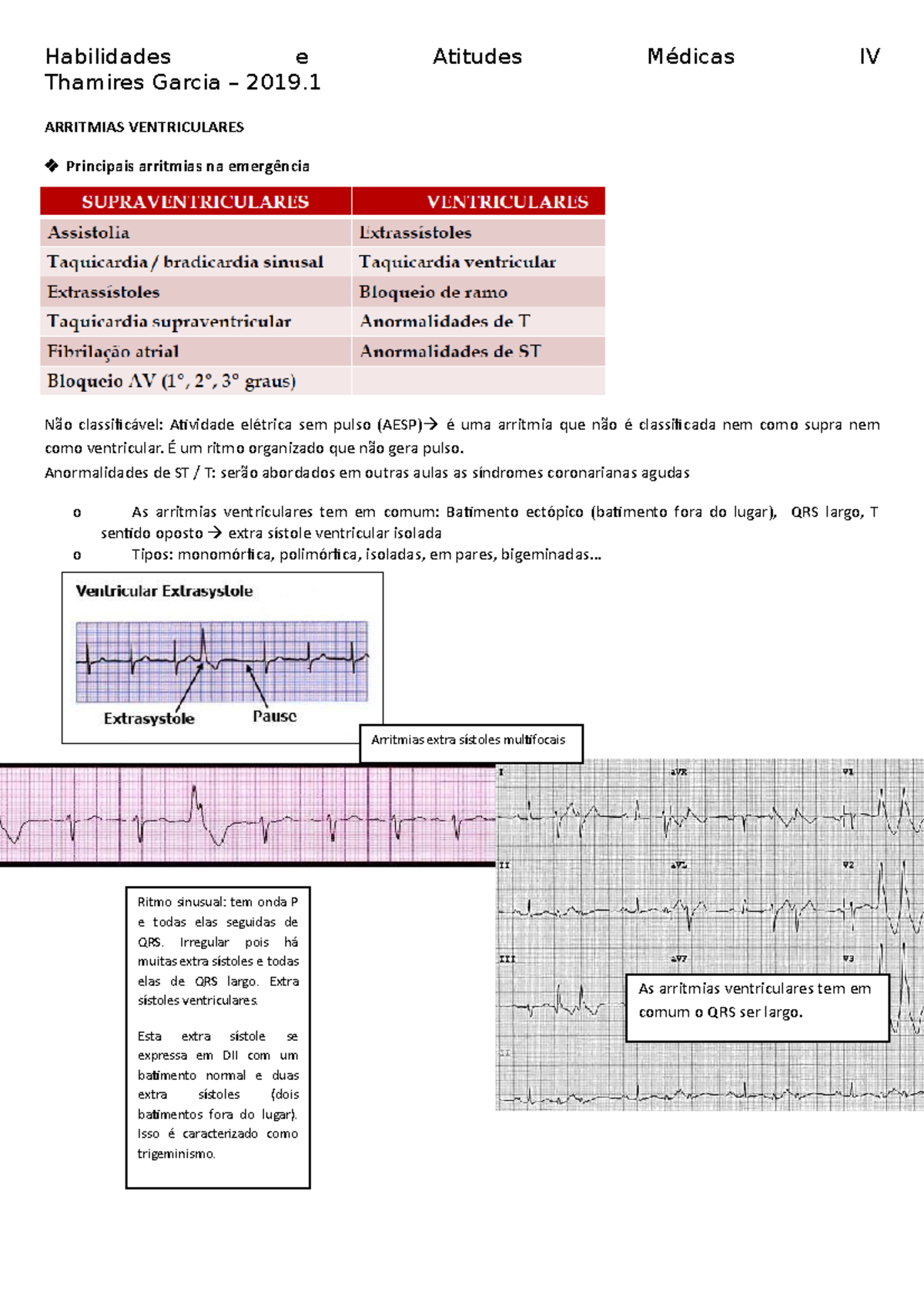 6 Arritmias Ventriculares - Thamires Garcia – 2019. ARRITMIAS ...