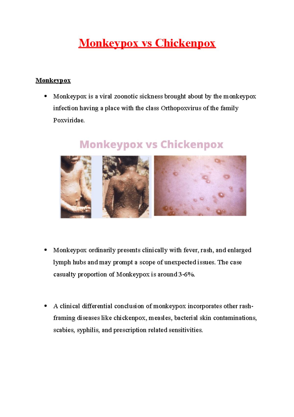 Monkeypox vs Chickenpox - Monkeypox vs Chickenpox Monkeypox Monkeypox ...