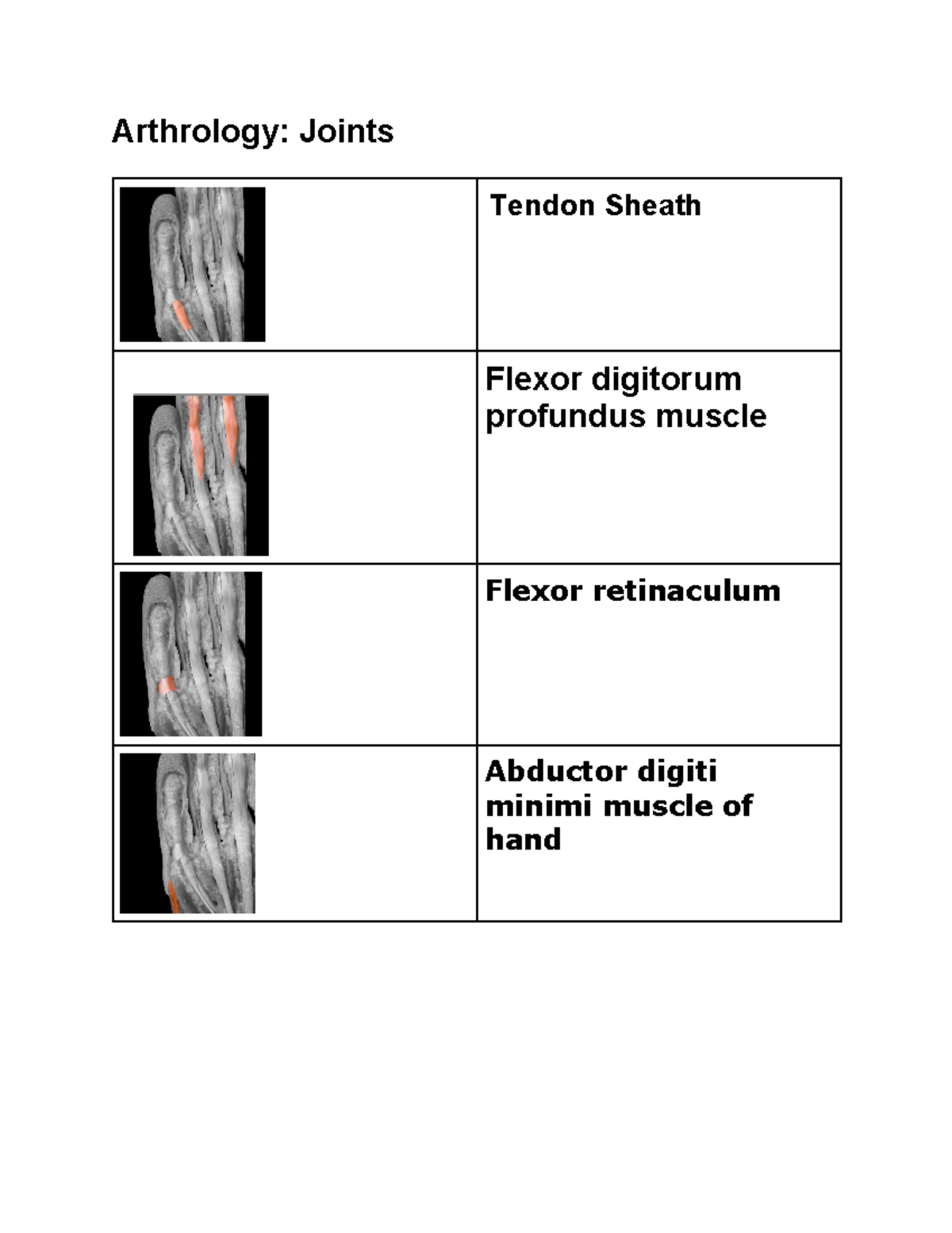 Notes for Practical - Arthrology: Joints Tendon Sheath Flexor digitorum ...