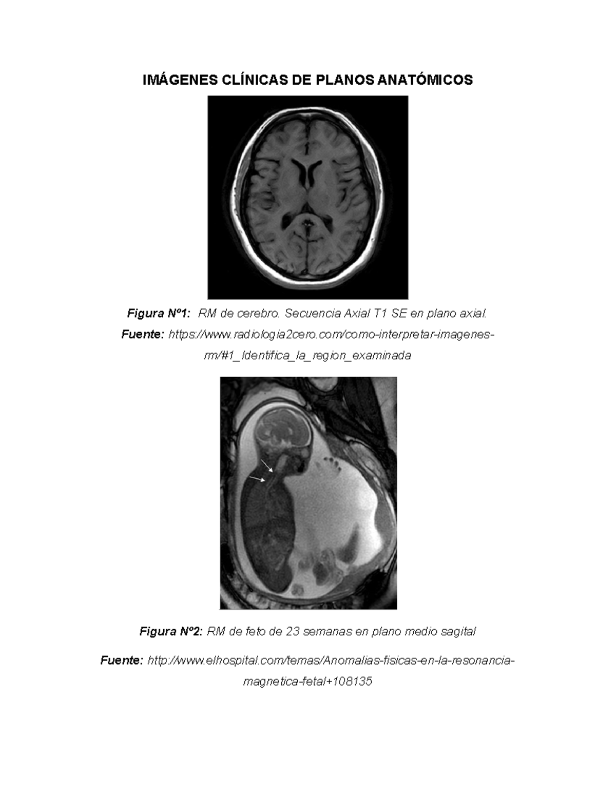 cerebro plano axial