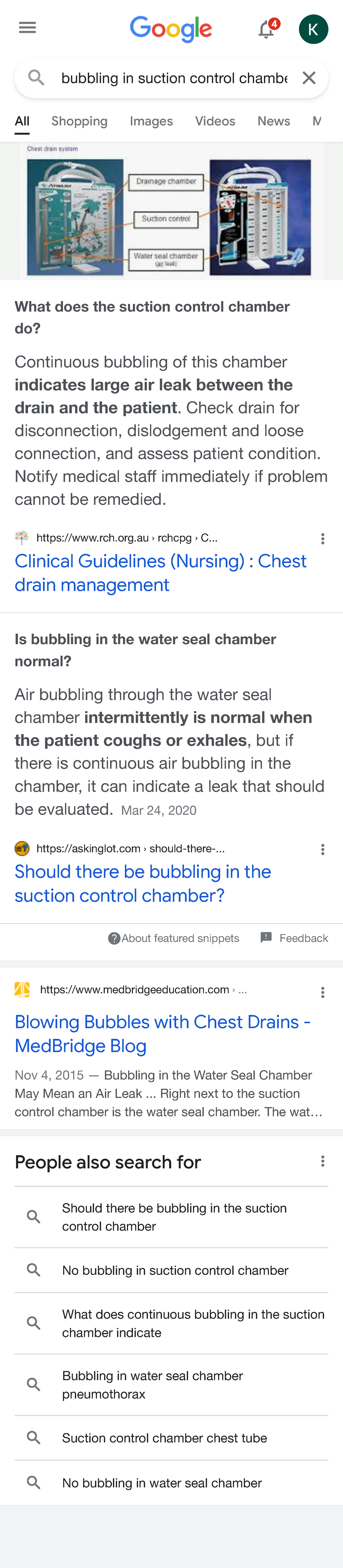 Bubbling in suction control chamber Google Search bubbling in