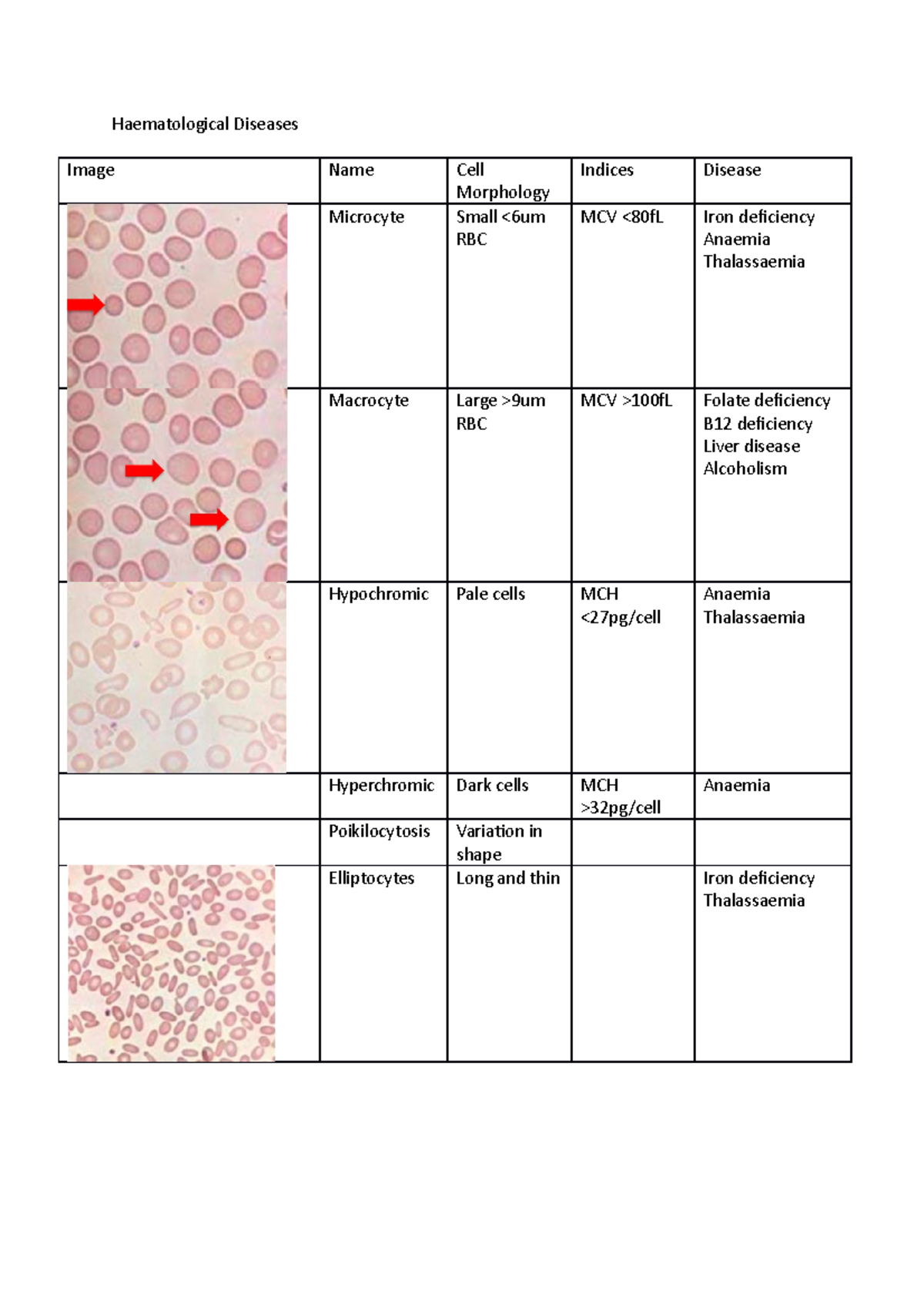 Haematological Diseases By Blood Film (with Images) - Haematological ...