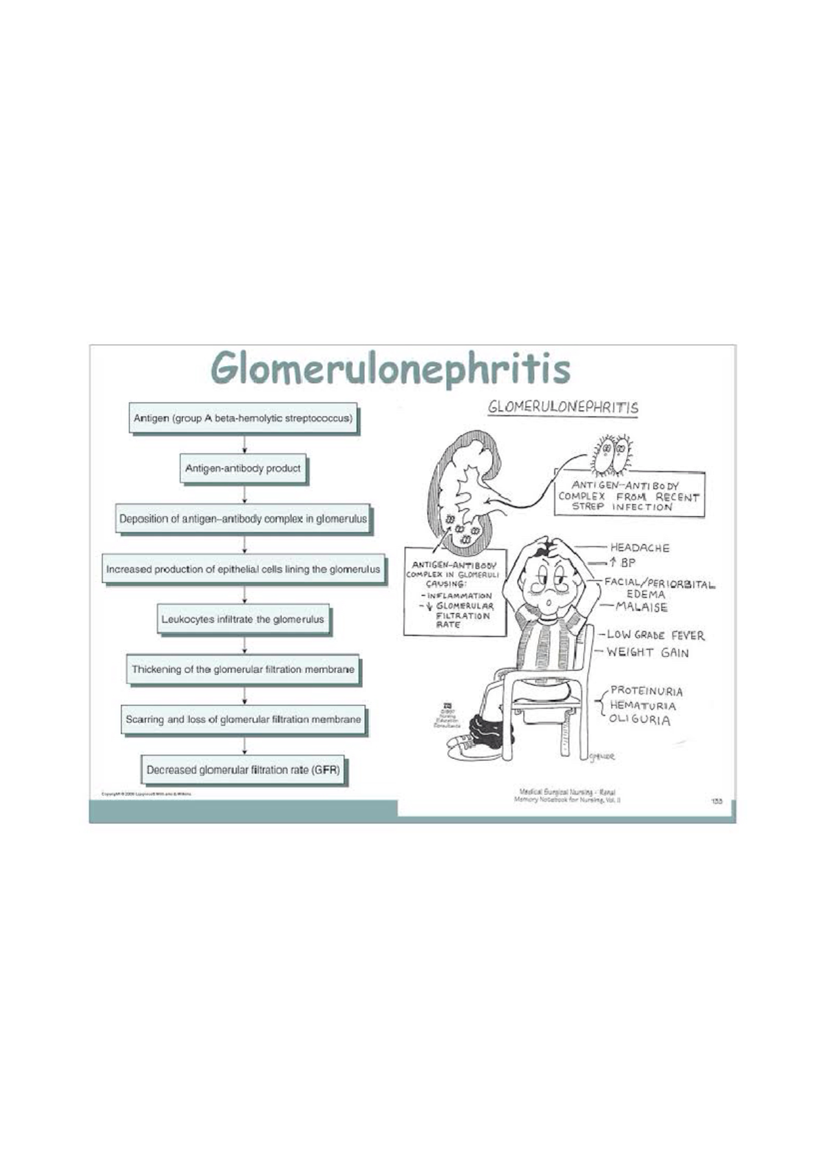 Pathology of Glomerulonephritis - Glomerulonephritis GLOMERULONEPHRITIS ...