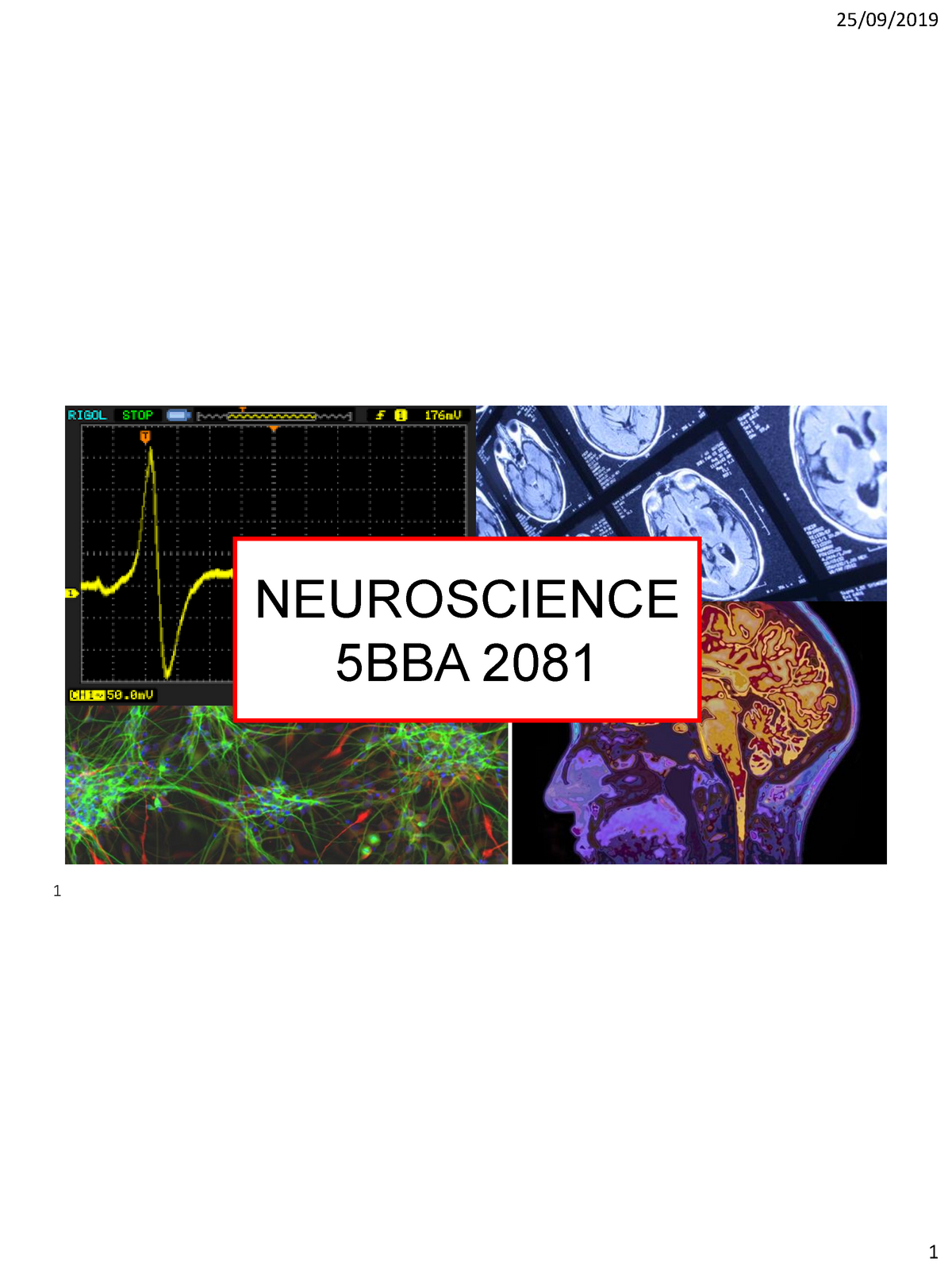 L1 Neuroscience - Warning: TT: Undefined Function: 32 NEUROSCIENCE 5BBA ...