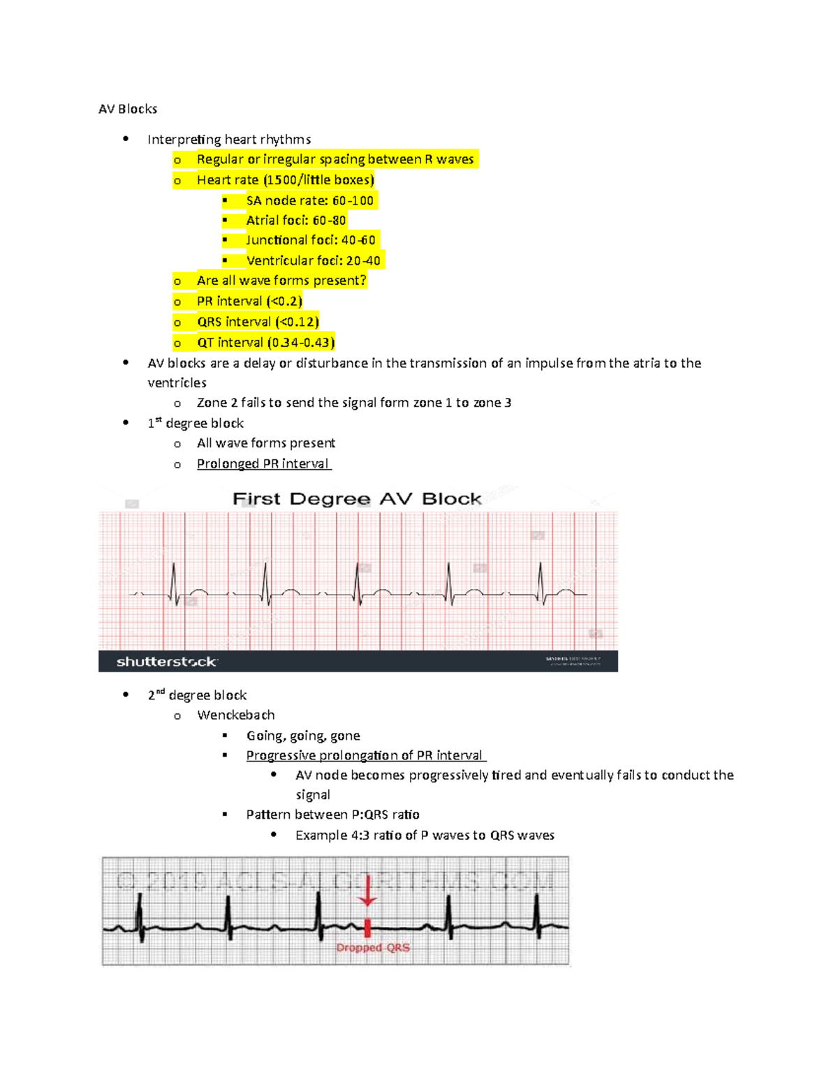 Exam 4 study guide - N/A - AV Blocks Interpreting heart rhythms o ...