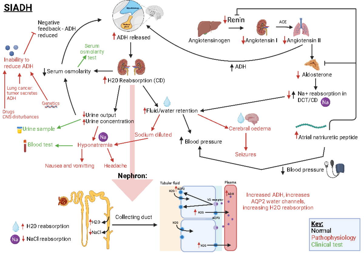 SIADH Flowchart - Hypothalamus Pituitarygland ADH released ...