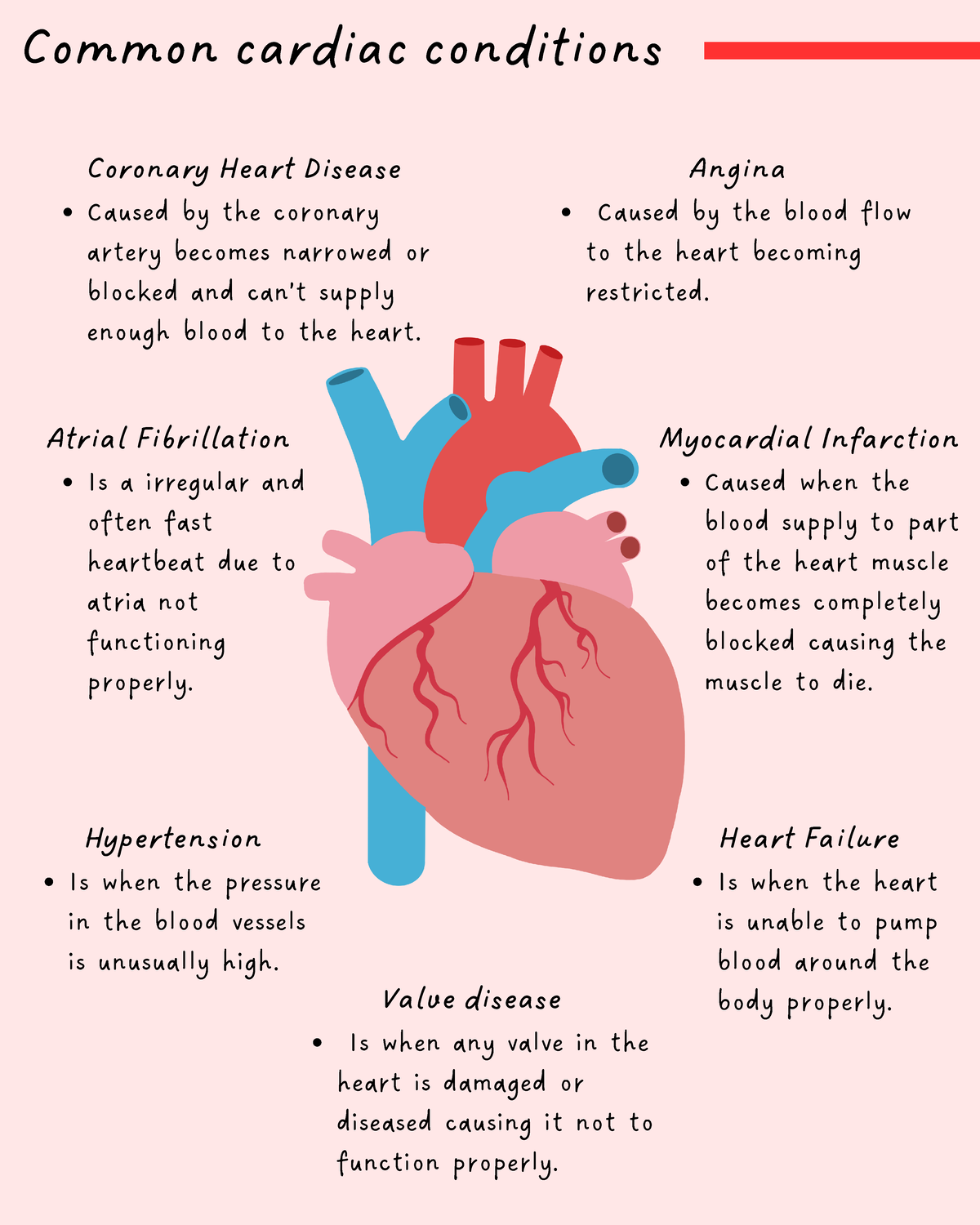 what-is-an-ecg-heartlungdoc