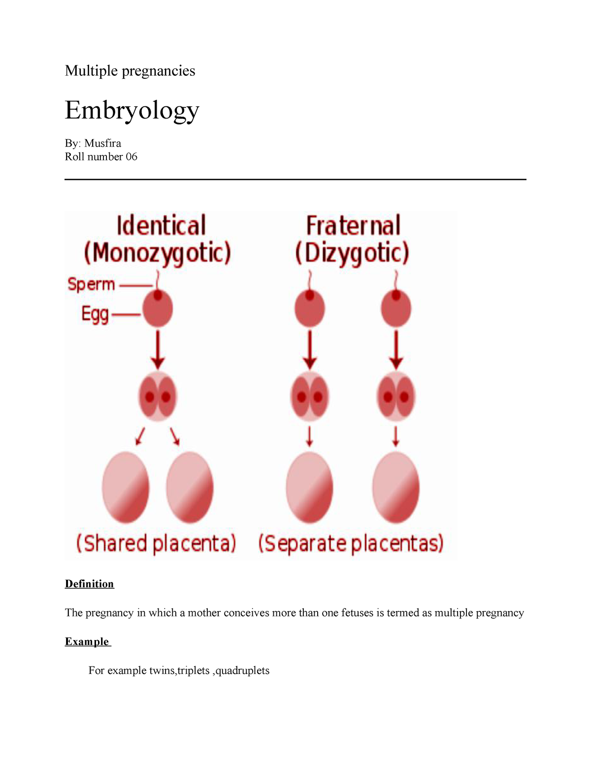 Multiple Pregnancies - Material For 1st Year MBBS - Multiple ...