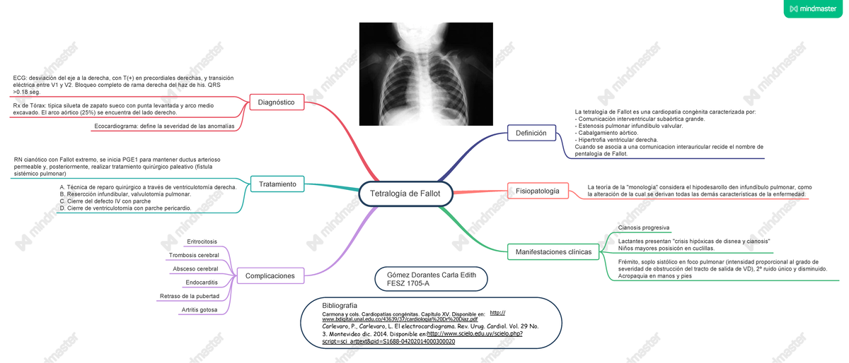 6. Tetralogía de Fallot Tetralogía de Fallot Definición
