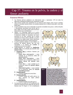 Clasificaciones De Fracturas De Ortopedia Y Traumatología, Miembro ...