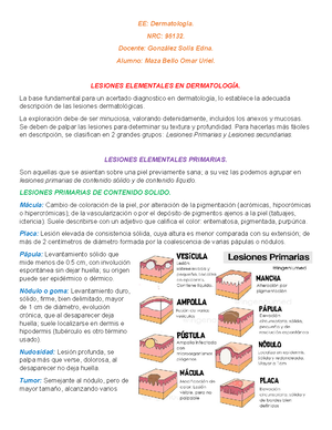 5. Keloids and Hypertrophic Scars Pathophysiology, Classification, and ...