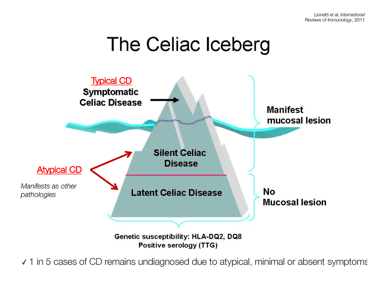 Related disease. Iceberg diseases. Эпидемиология целиакии.