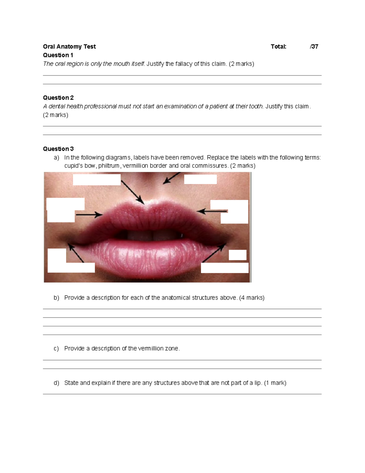 Oral Anatomy Test test Oral Anatomy Test Total / Question 1 The