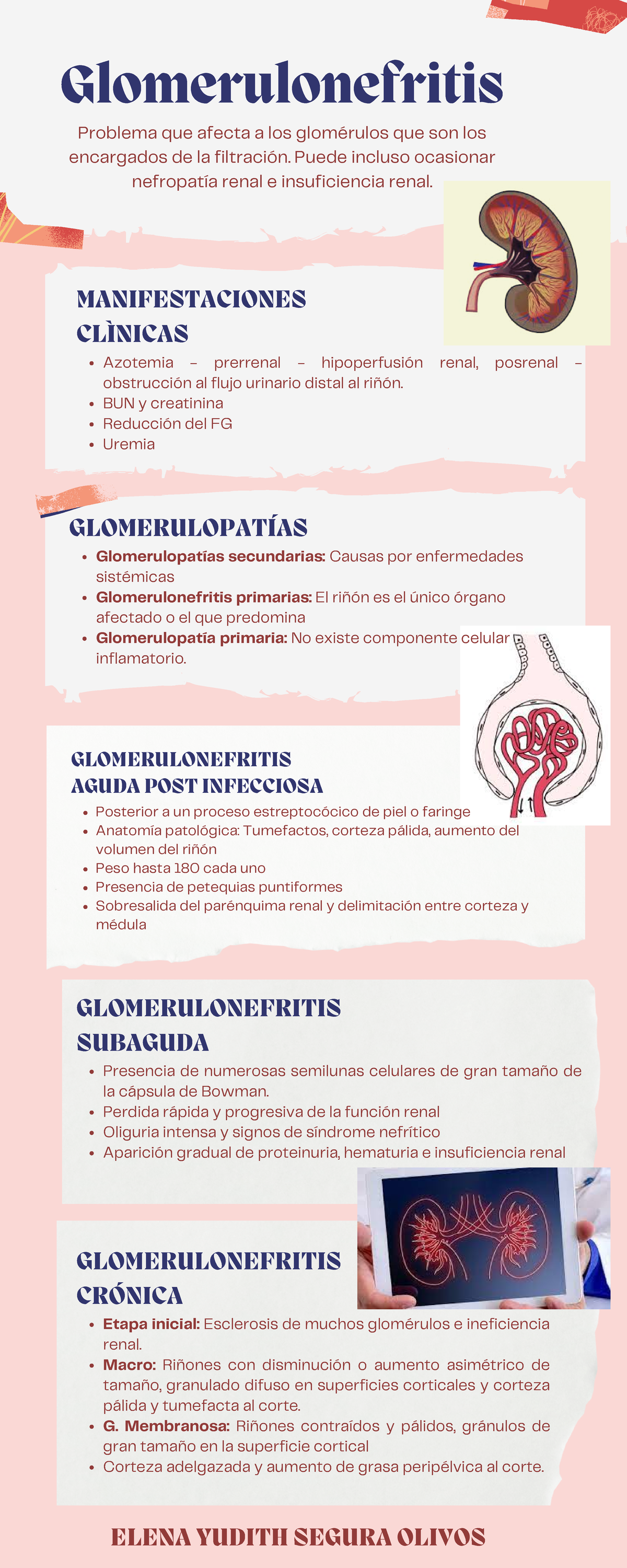 3. Resumen DE Glomerulonefritis - Azotemia - Prerrenal - Hipoperfusión ...