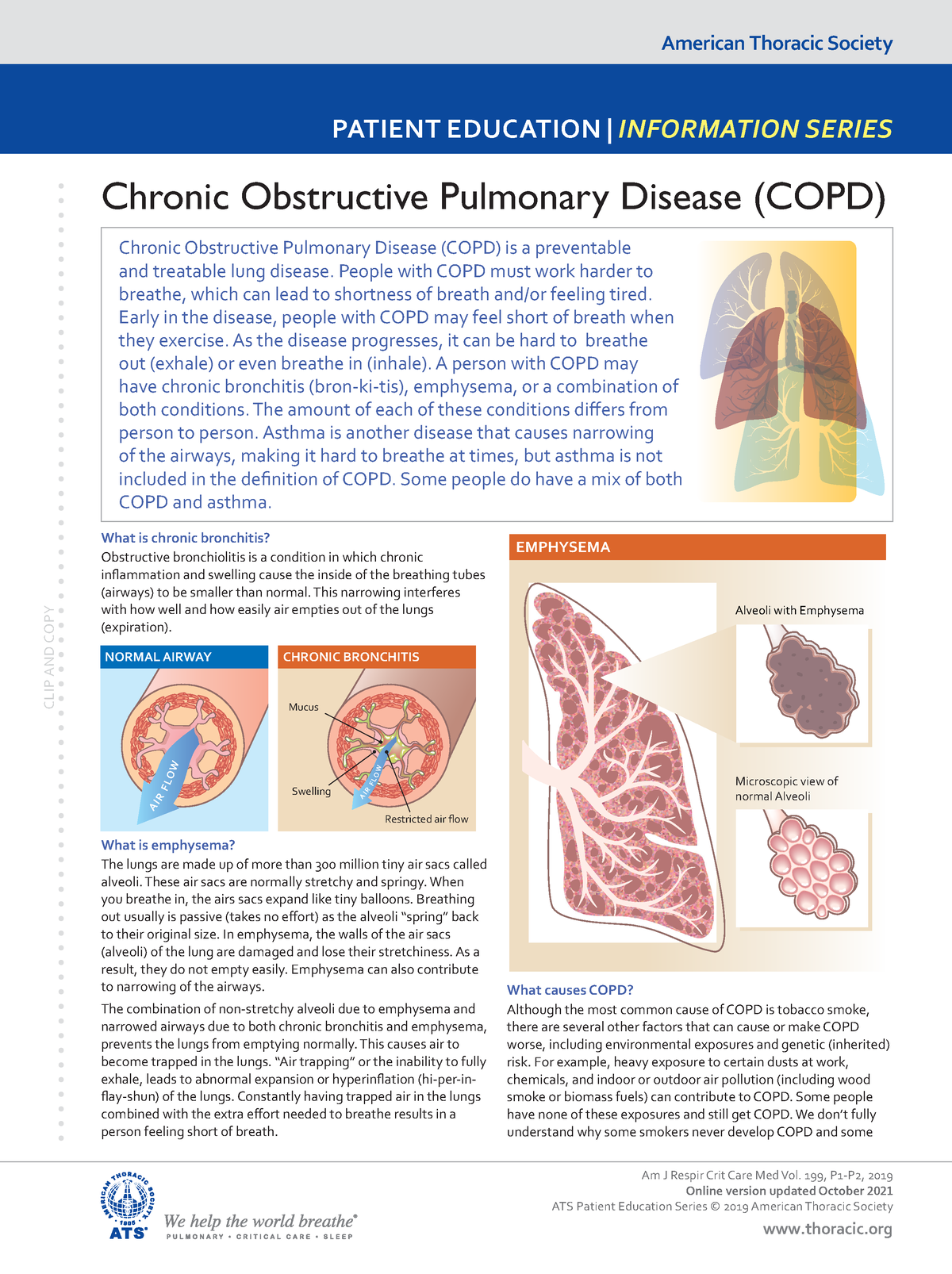 copd case study physio