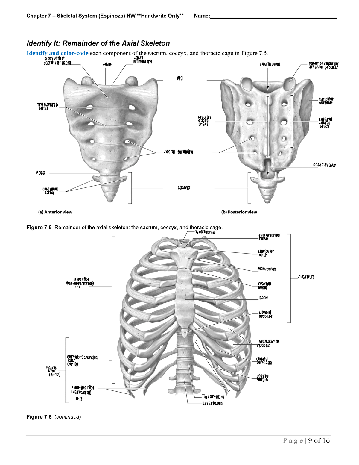 Chapter 7 skeletal system - Chapter 7 – Skeletal System (Espinoza) HW ...