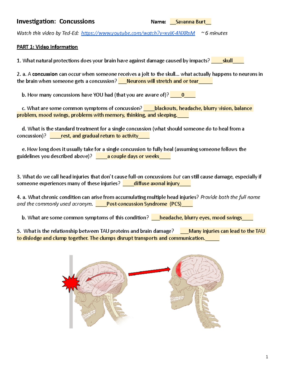 Concussion Protocol for Becton; Camp Notes 08/25/21