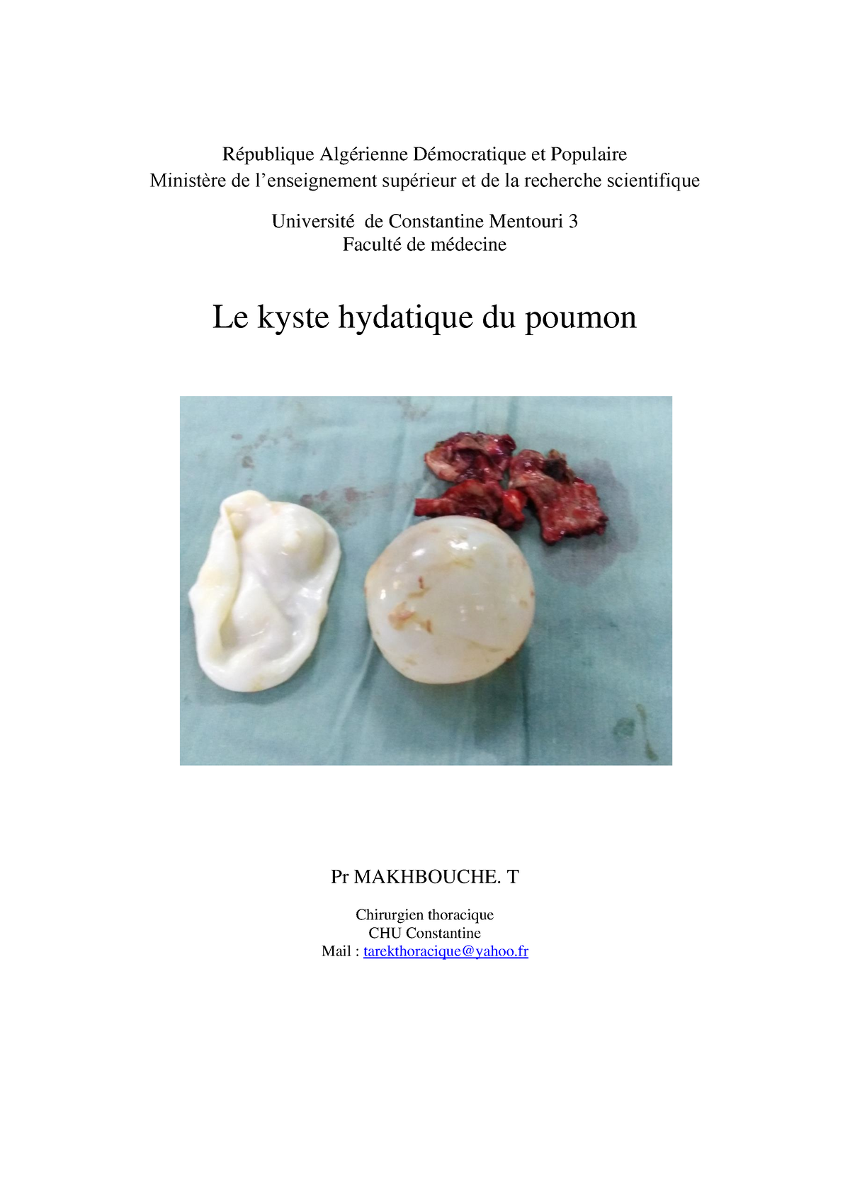 Le Kyste Hydatique Du Poumon - République Algérienne Démocratique Et ...