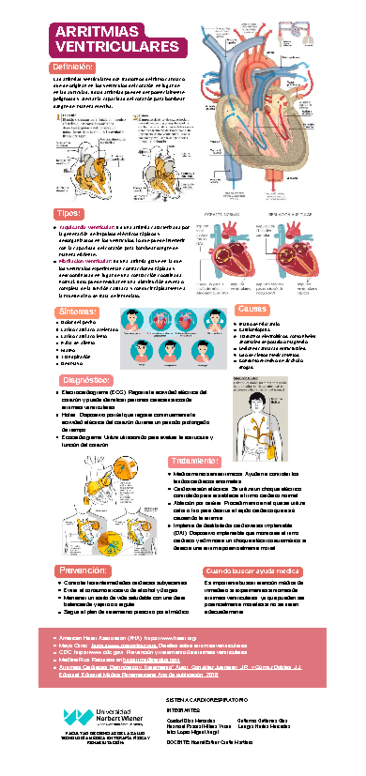 Arritmias Ventriculares (Infografías) - ARRITMIAS VENTRICULARES ...