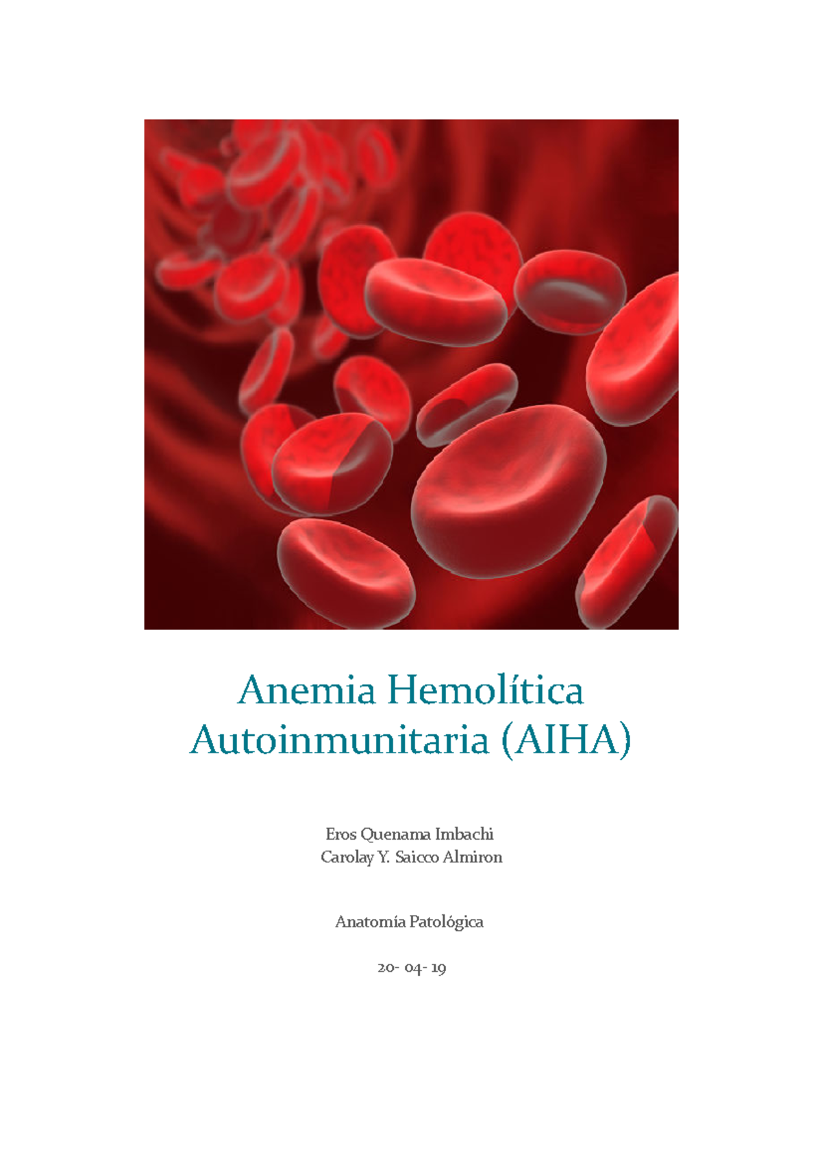 Anemia Hemolítica Autoinmunitaria Anemia Hemolítica Autoinmunitaria Aiha Eros Quenama 2182