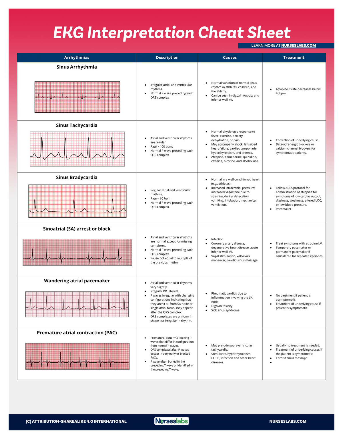 EKG-Interpretation-Cheat-Sheet-for-Heart-Arrhythmias Nurseslabs 1 ...