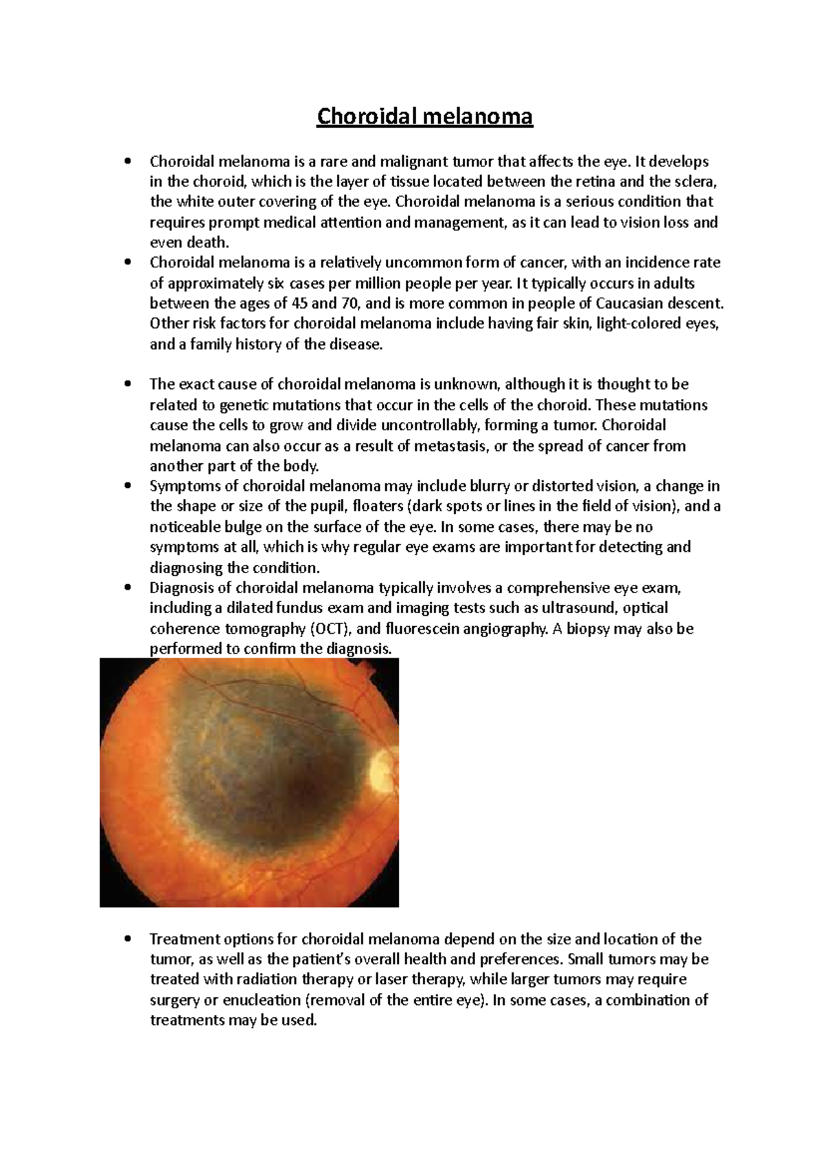 Choroidal melanoma - n/a - Choroidal melanoma Choroidal melanoma is a ...