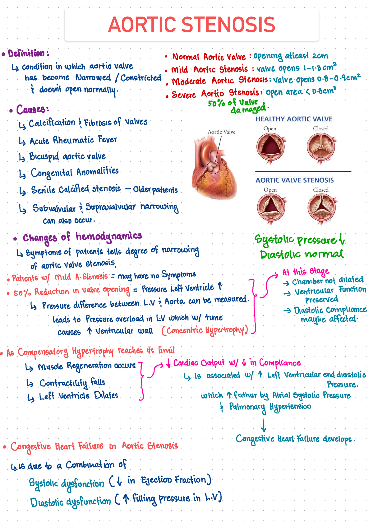 Aortic Stenosis Cardiology - AORTIC STENOSIS oDefinition : Normal ...