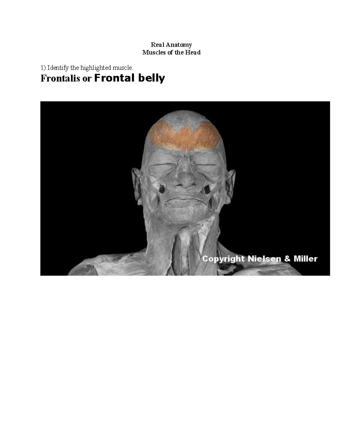 muscles of the head Worksheet - BIO 118 - Real Anatomy Muscles of the ...