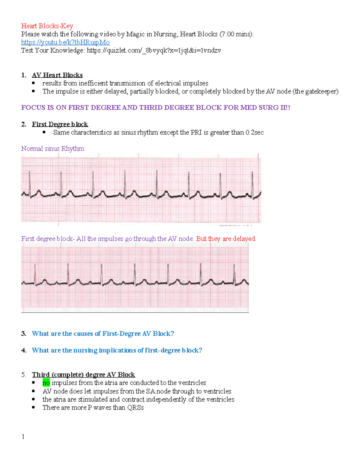 4. heart blocks Student - completed - Please watch the following video ...