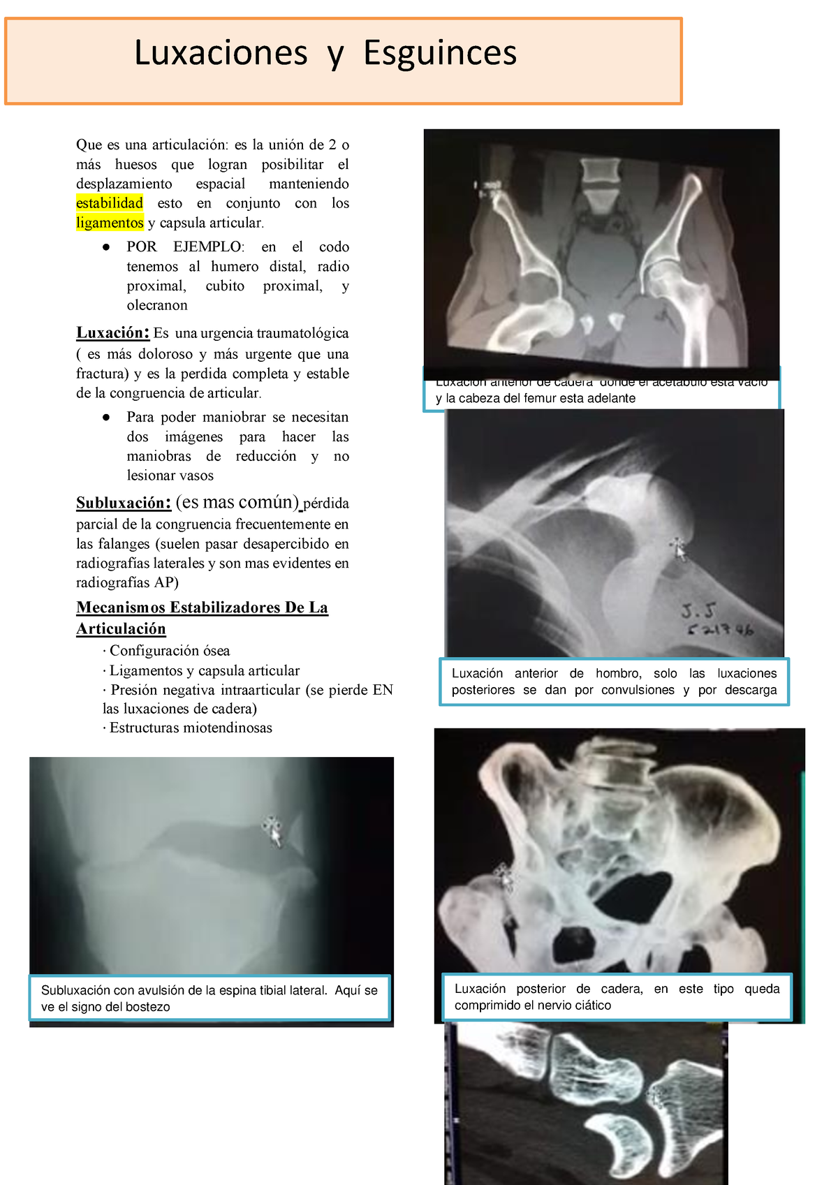 4. Luxaciones Y Esguinses - Que Es Una Articulación: Es La Unión De 2 O ...