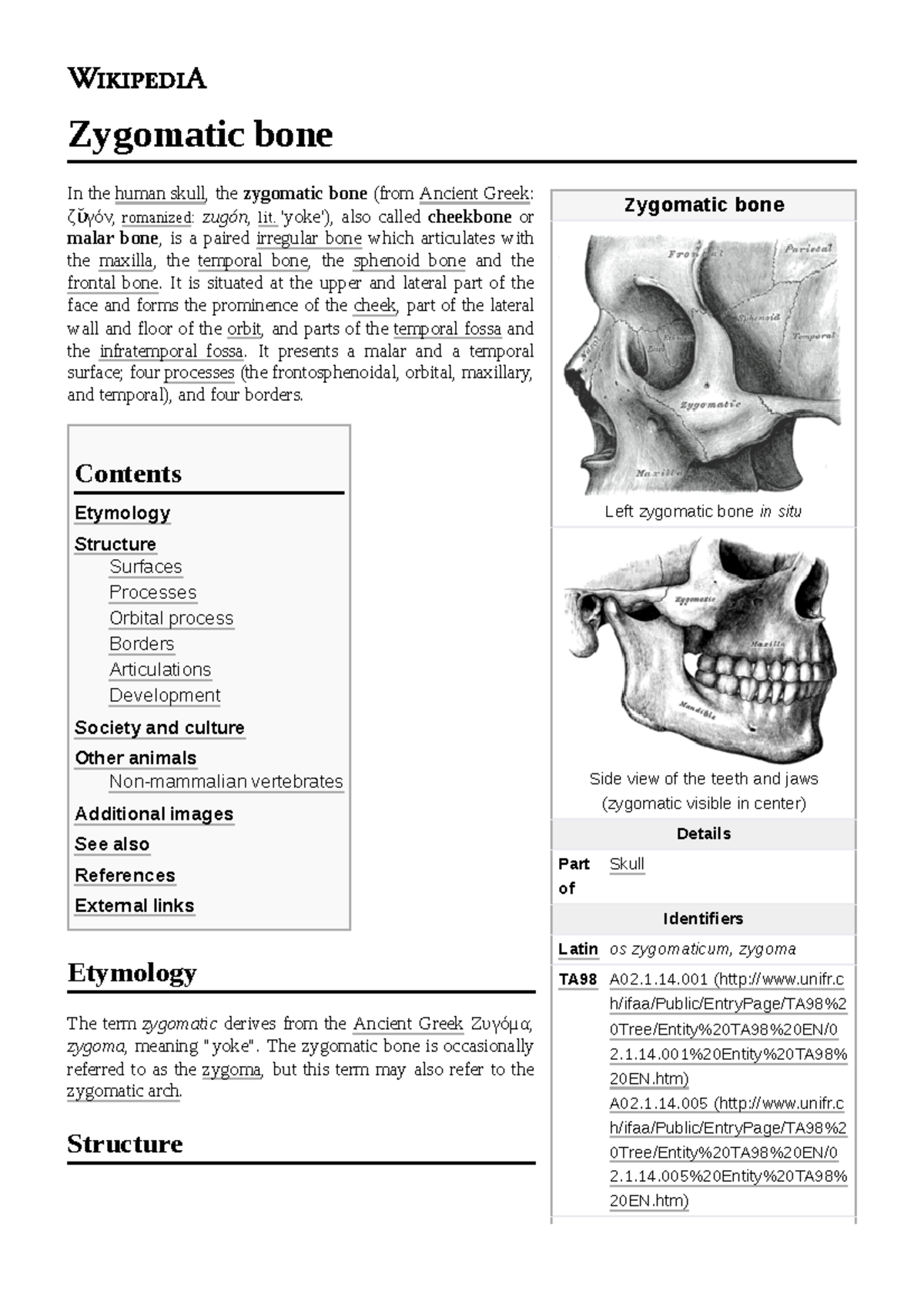 Zygomatic bone nth Zygomatic bone Left zygomatic bone in situ Side