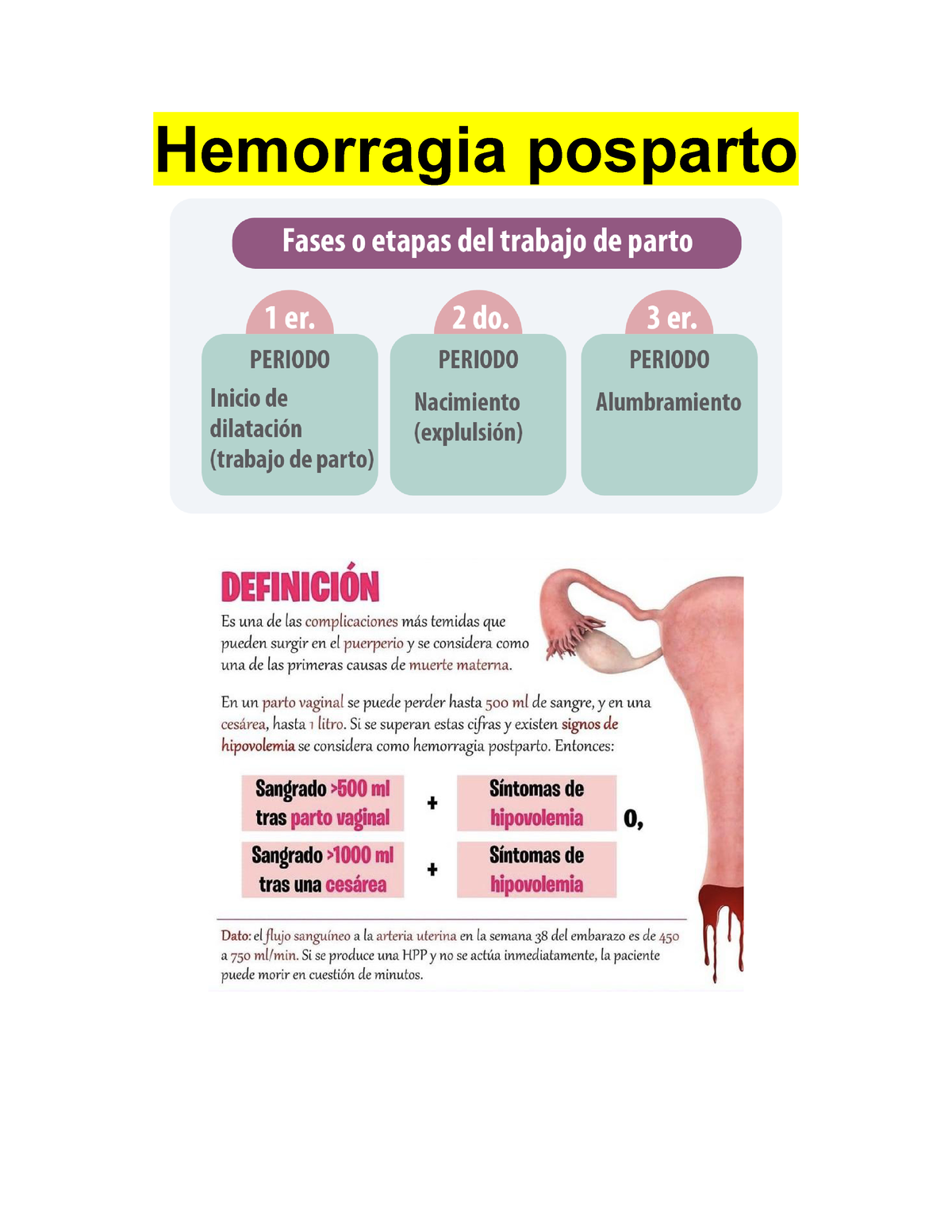 Hemorragia Postparto, Williams Edicion 25 RESUMEN - Hemorragia Posparto ...