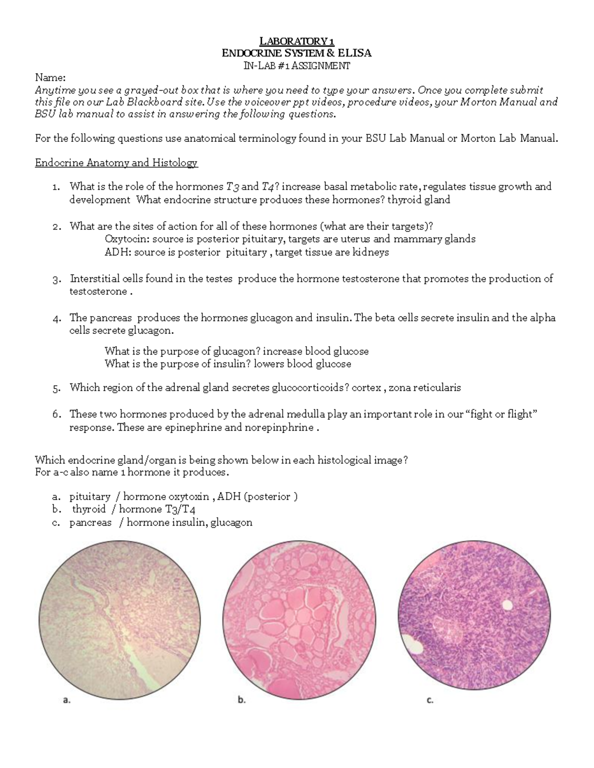 Lab 1 Endocrine lab LABORATORY 1 ENDOCRINE SYSTEM & ELISA INLAB 1