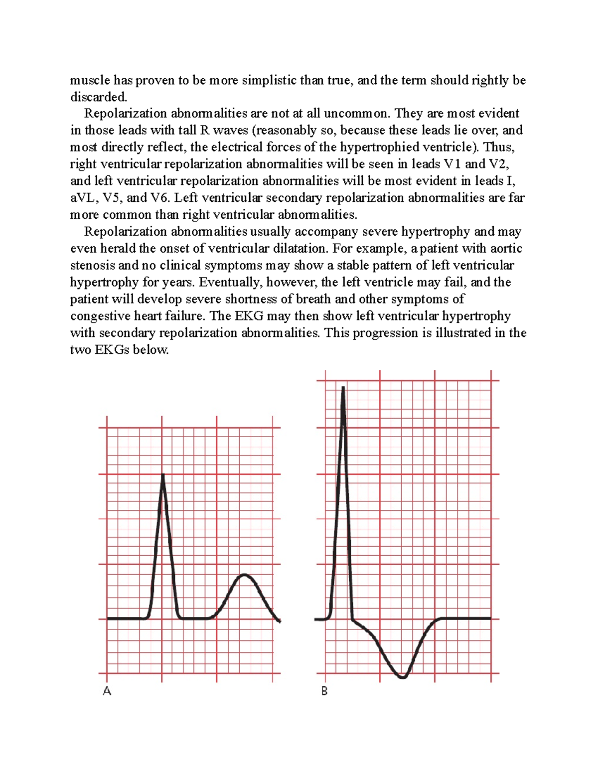 The only EKG-38 - The only EKG - muscle has proven to be more ...