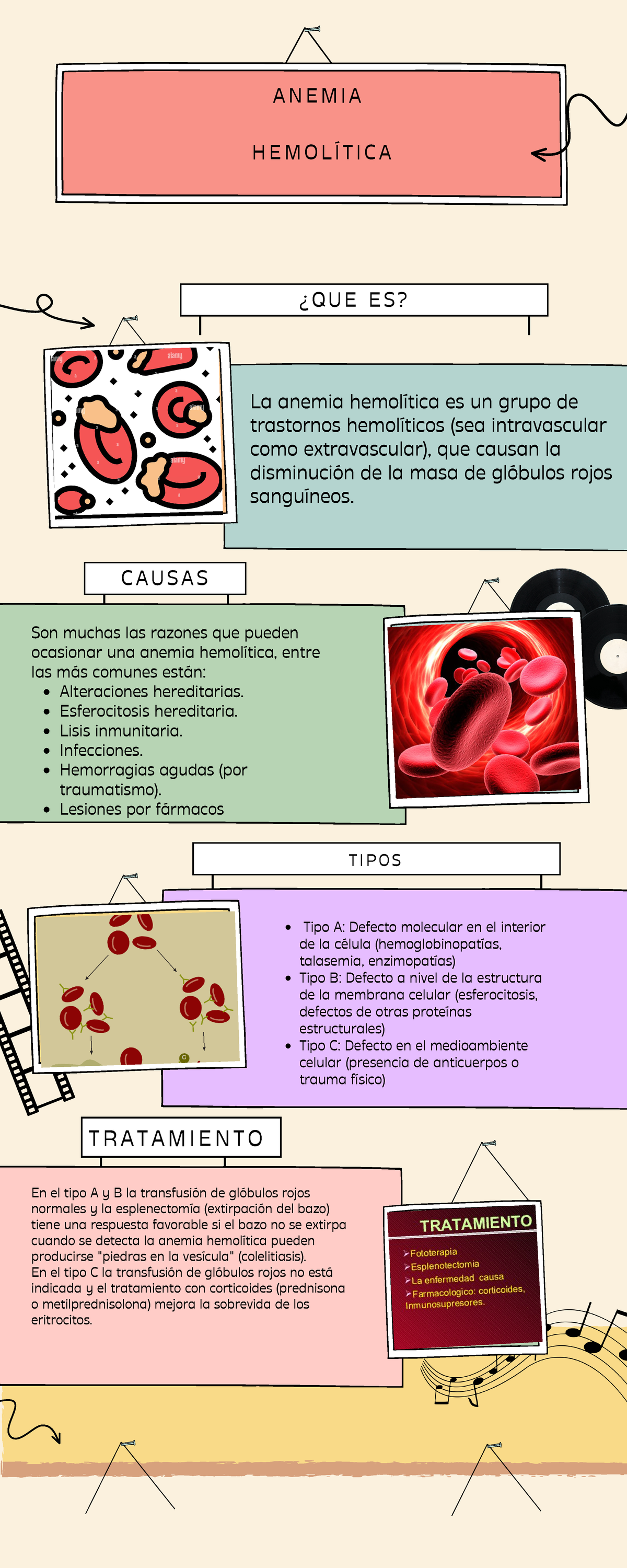 Anemia Hemol Tica Apunte Tipos Alteraciones Hereditarias Esferocitosis Hereditaria Lisis