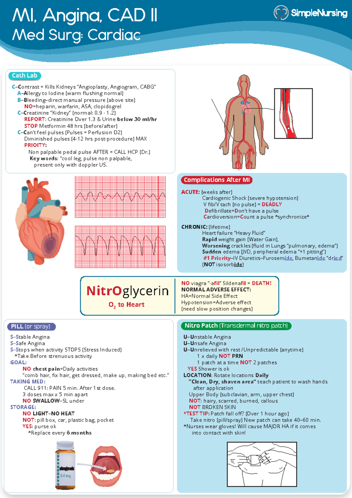 Cardiac - MI, Angina, CAD - Cath Lab - MI, Angina, CAD II Med Surg ...