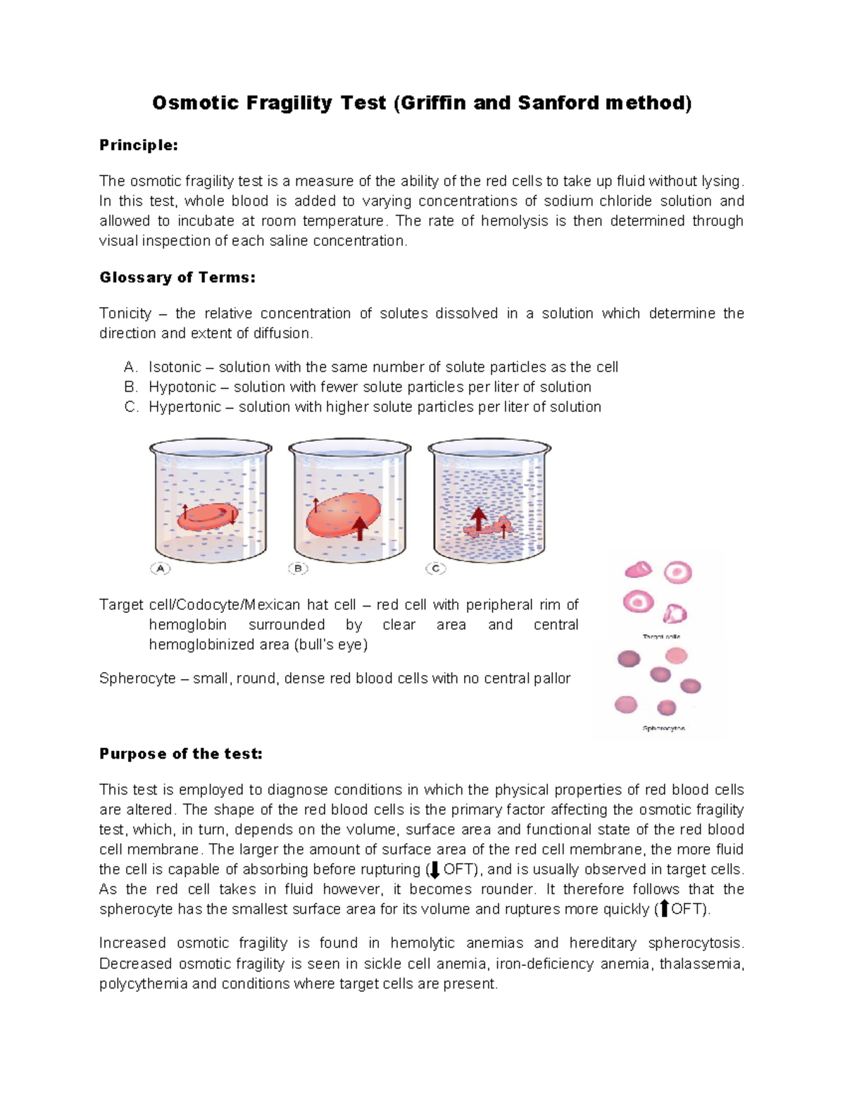 7 Osmotic fragility test In this test, whole blood is added to