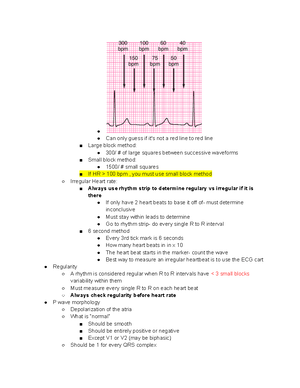 Junctional - notes for final exam - If heart rate is slow, the patient ...