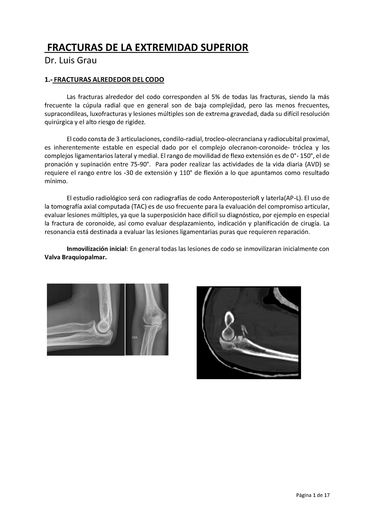 Apunte Fracturas Extremidad Superior - FRACTURAS DE LA EXTREMIDAD ...