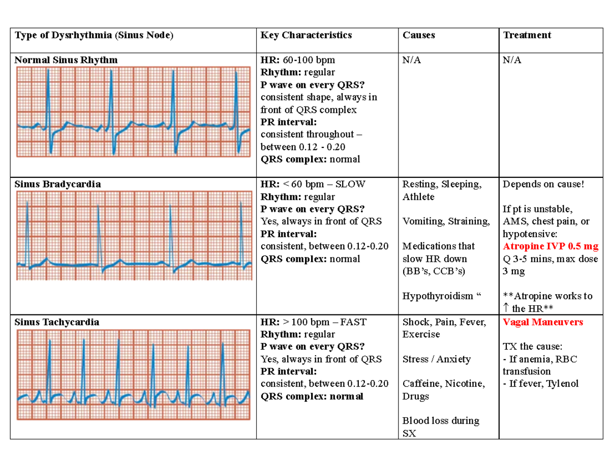 Dysrhythmias - QRS complex: normal N/A N/A Sinus Bradycardia HR: