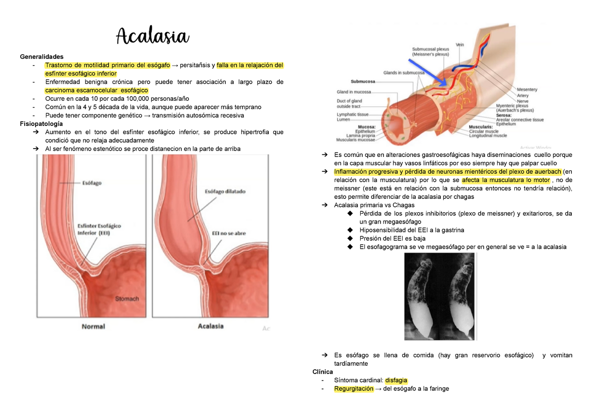 Generalidades acalasia, clínica y tratamiento - Generalidades - Trastorno  de motilidad primario del - Studocu