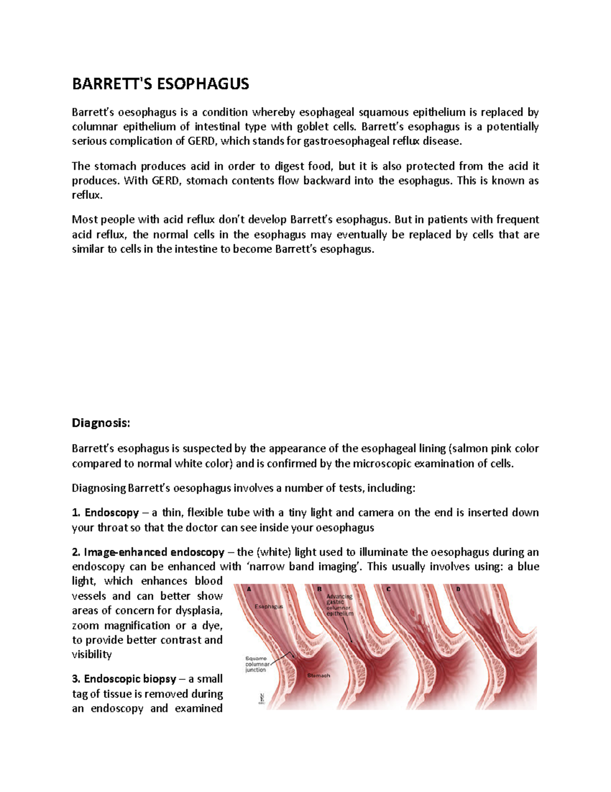 Barrett’s oesophagus BARRETT'S ESOPHAGUS Barrett's oesophagus is a
