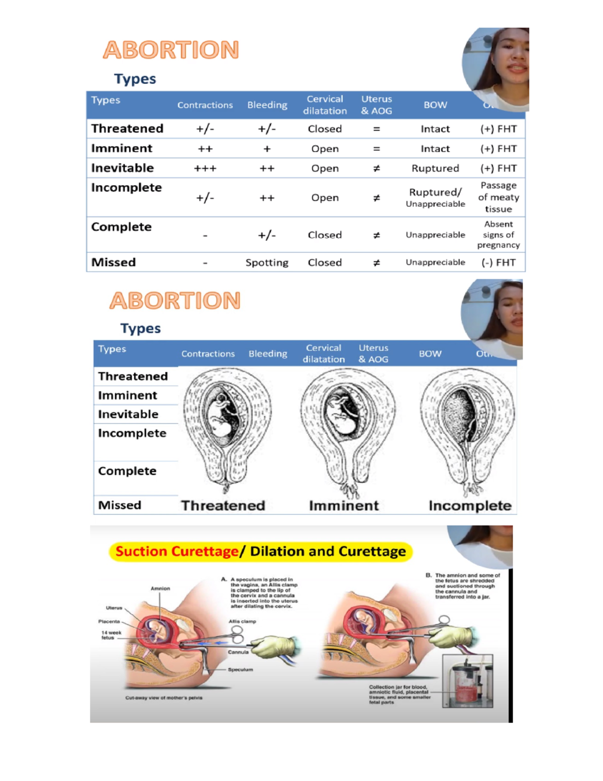 lecture-1-types-of-abortion-bleeding-in-pregnancy-abortion