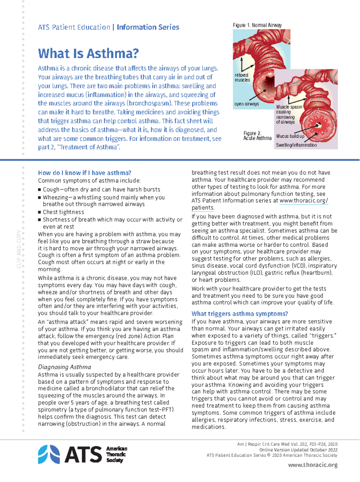 Asthma - thoracic CLIP AND COPY ATS Patient Education | Information ...